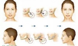 成都医疗整形爆料事件最新,揭秘行业乱象，患者权益如何保障？